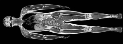 Image IRM du corps entier (cliché Hôpital privé de Thiais)